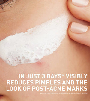 CeraVe Acne Clay To Foam Cleanser Cerave