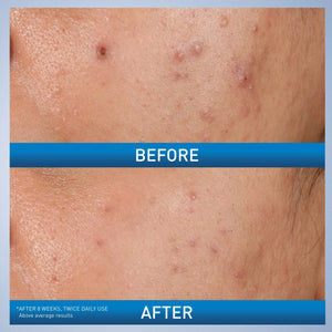 https://allurify.pk/products/cerave-blemish-control-gel?variant=48239671017788
