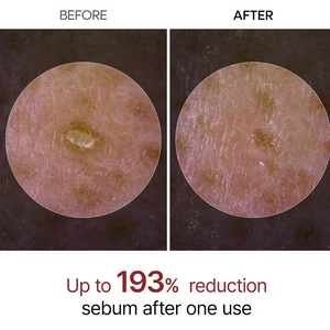 Dr.Melaxin Peel Shot Exfoliant White Rice Ampoule Dr.Melaxin