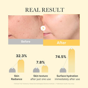 https://allurify.pk/products/medicube-kojic-acid-turmeric-gel-mask-4ea