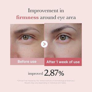 https://allurify.pk/products/medicube-pdrn-pink-peptide-eye-cream?variant=51735960420668
