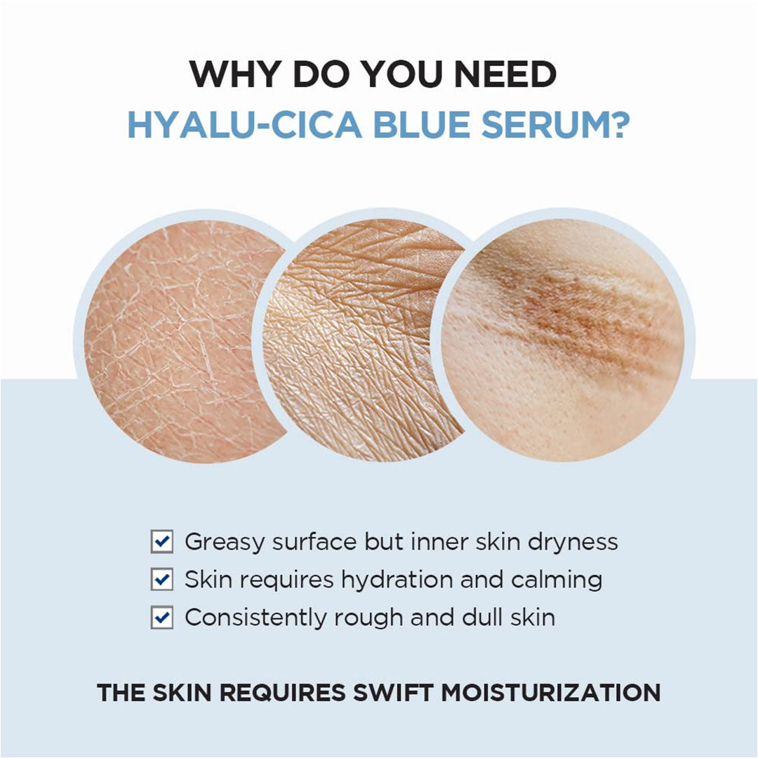 https://allurify.pk/products/skin1004-hyalu-cica-blue-serum-multi-care-solutions?_pos=1&_psq=hyalu+cica+blue+serum&_ss=e&_v=1.0