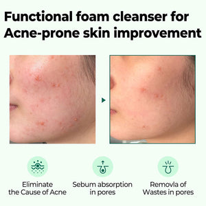 https://allurify.pk/products/some-by-mi-aha-bha-pha-30-days-miracle-acne-clear-foam?_pos=1&_psq=acne+aha+bha&_ss=e&_v=1.0