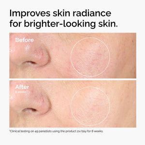 https://allurify.pk/products/the-ordinary-alpha-arbutin-2-ha-30ml?variant=51723054547260