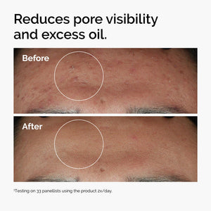 https://allurify.pk/products/the-ordinary-niacinamide-10-zinc-1-30ml?variant=51723044258108