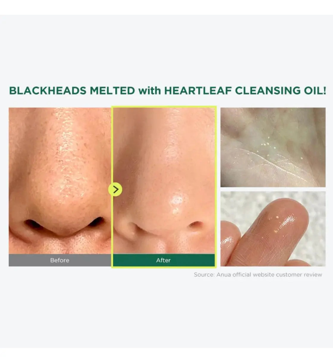 Anua Heartleaf Pore Control Cleansing Oil