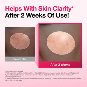 Anua Niacinamide 10% + TXA 4% Dark Spot Correcting Serum Anua