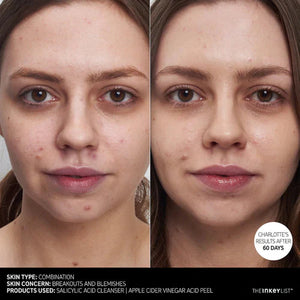 The Inkey List Salicylic Acid Cleanser The Inkey List