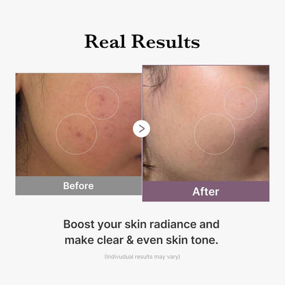 https://allurify.pk/products/medicube-age-r-glutathione-glow-toner?variant=51143305134396