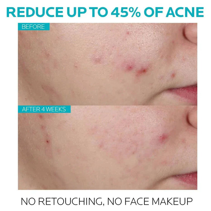 https://allurify.pk/products/la-roche-posay-effaclar-salicylic-acid-acne-serum?_pos=1&_psq=effaclar+salicylic&_ss=e&_v=1.0