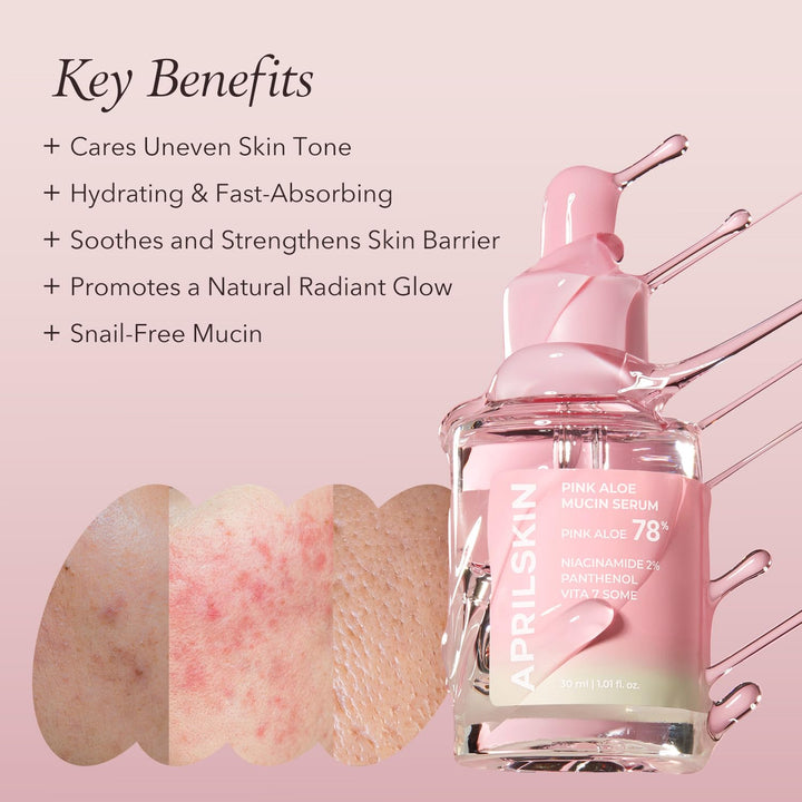 https://allurify.pk/products/aprilskin-pink-aloe-mucin-serum