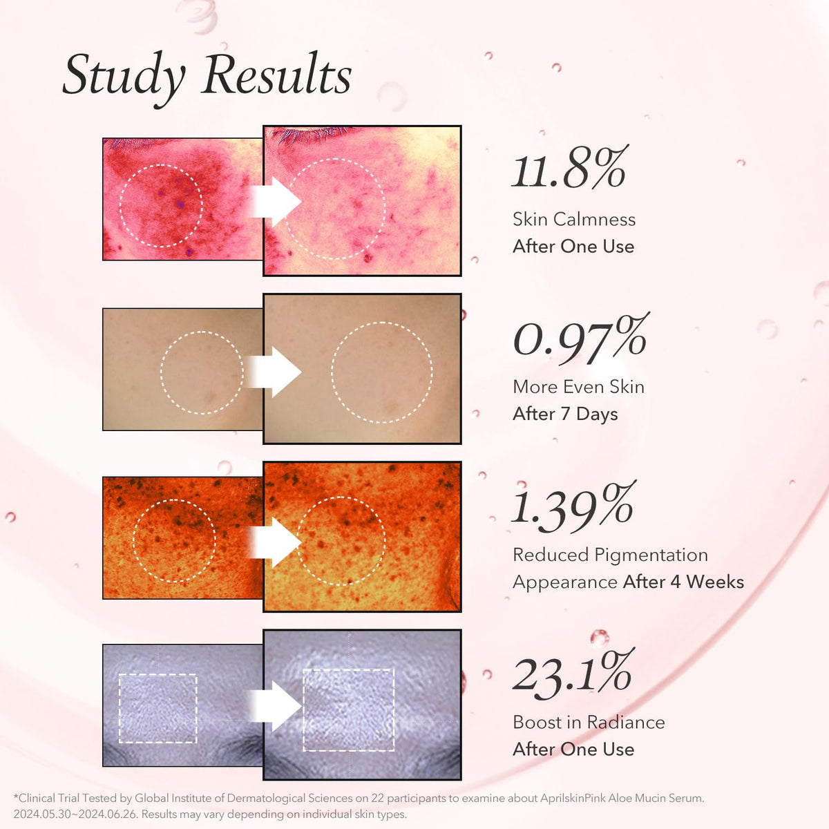 https://allurify.pk/products/aprilskin-pink-aloe-mucin-serum