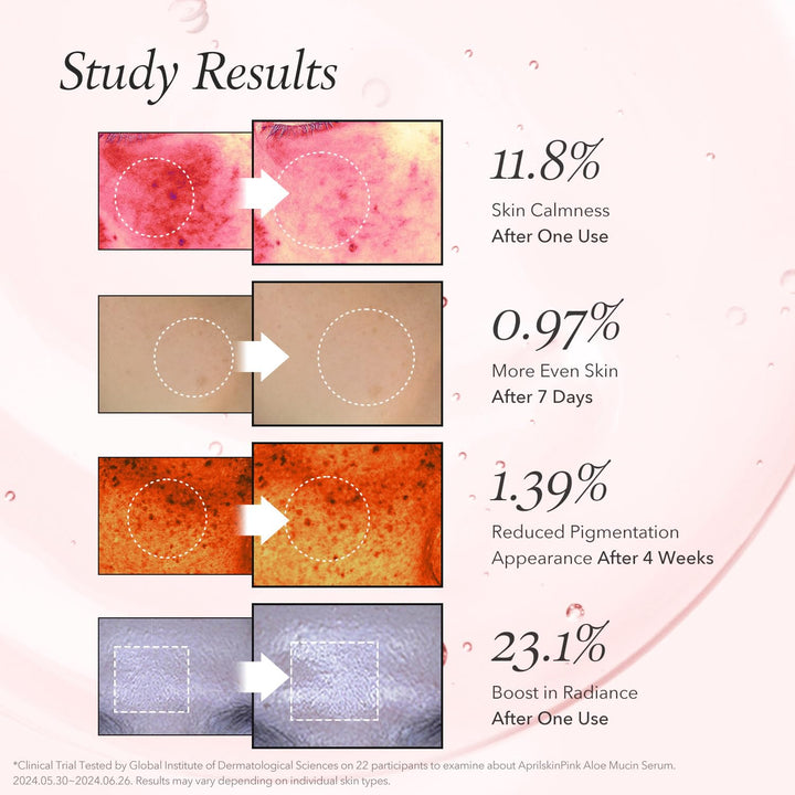 https://allurify.pk/products/aprilskin-pink-aloe-mucin-serum