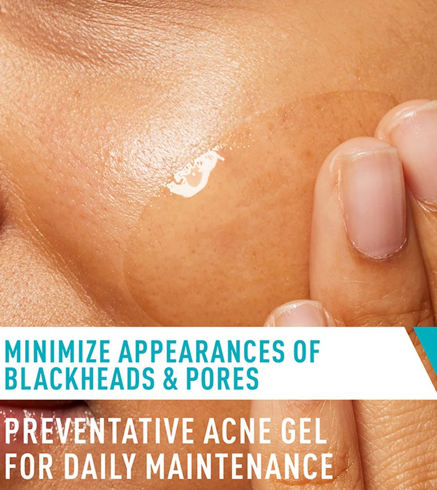 Cerave Acne Control Gel