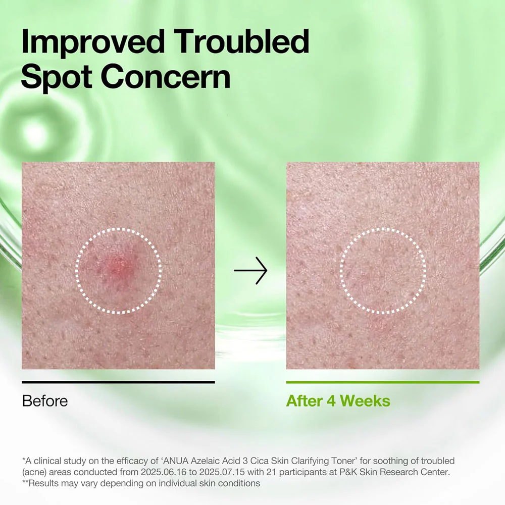 Anua Azelaic Acid 3 Cica Skin Clarifying Toner