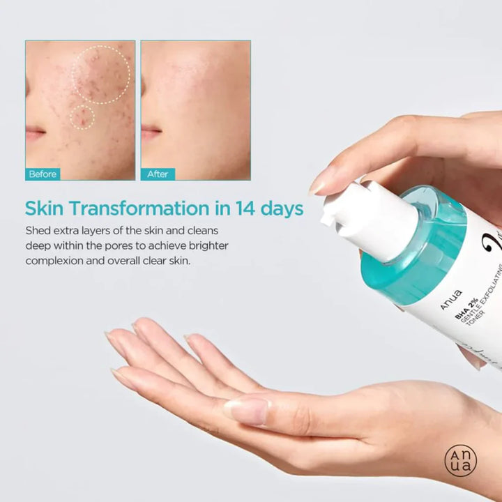 https://allurify.pk/products/anua-bha-2-gentle-exfoliating-toner?utm_source=copyToPasteBoard&utm_medium=product-links&utm_content=web