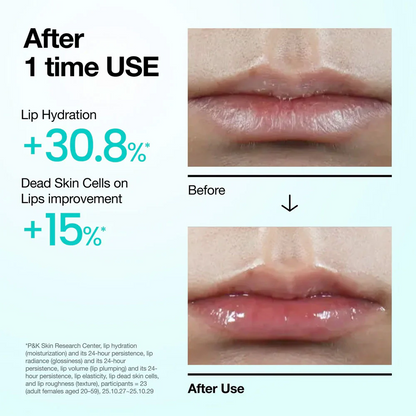 Anua PDRN Lip Serum 10 ml