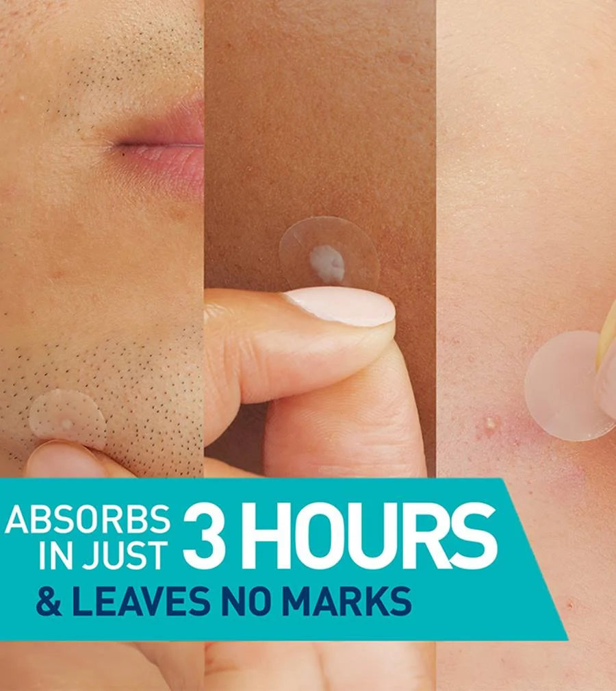 CeraVe Blemish Barrier Patches Cerave