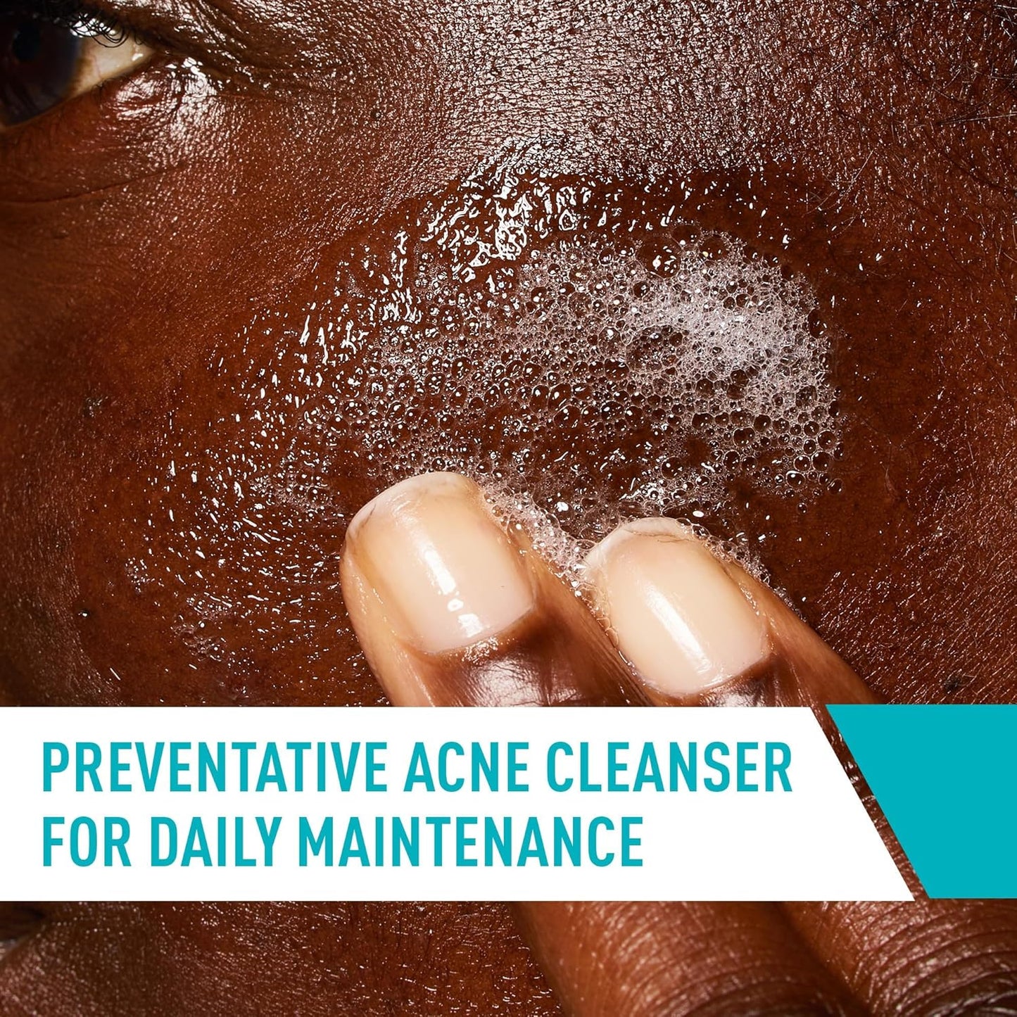 https://allurify.pk/products/cerave-acne-control-cleanser-237-ml?variant=48253885874492