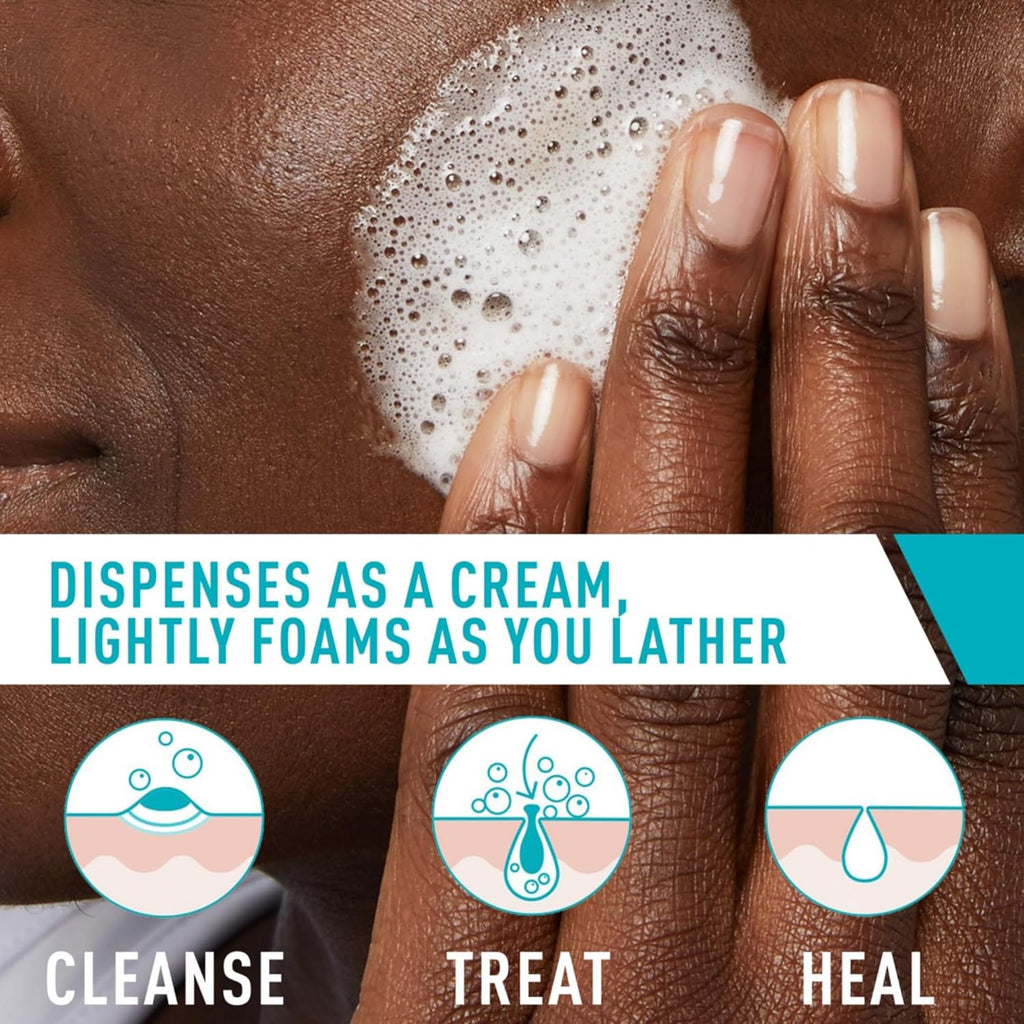 https://allurify.pk/products/cerave-acne-foaming-cream-cleanser-benzoyl-peroxide-acne-treatment-150ml?variant=48253833085244