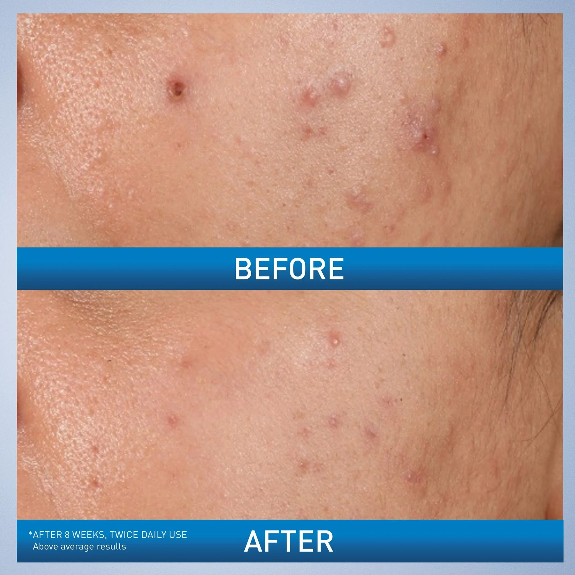 https://allurify.pk/products/cerave-blemish-control-gel?variant=48239671017788