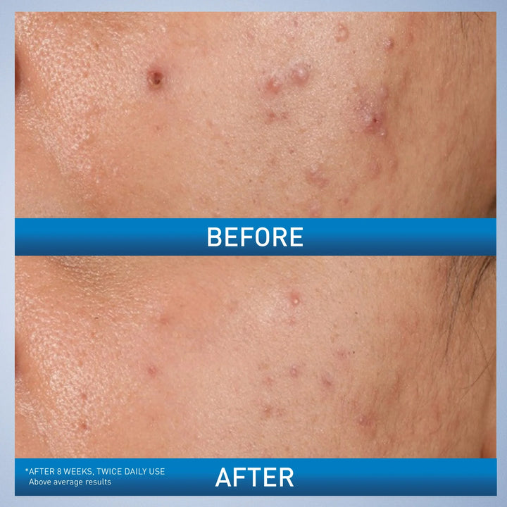 https://allurify.pk/products/cerave-blemish-control-gel?variant=48239671017788