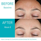 https://allurify.pk/products/cerave-resurfacing-retinol-serum?variant=48270520844604