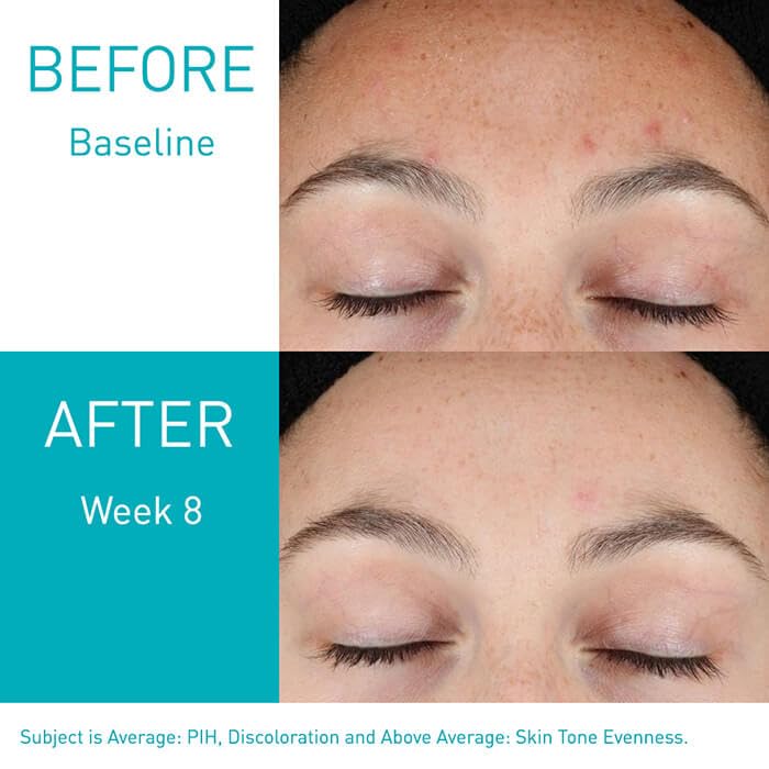 https://allurify.pk/products/cerave-resurfacing-retinol-serum?variant=48270520844604