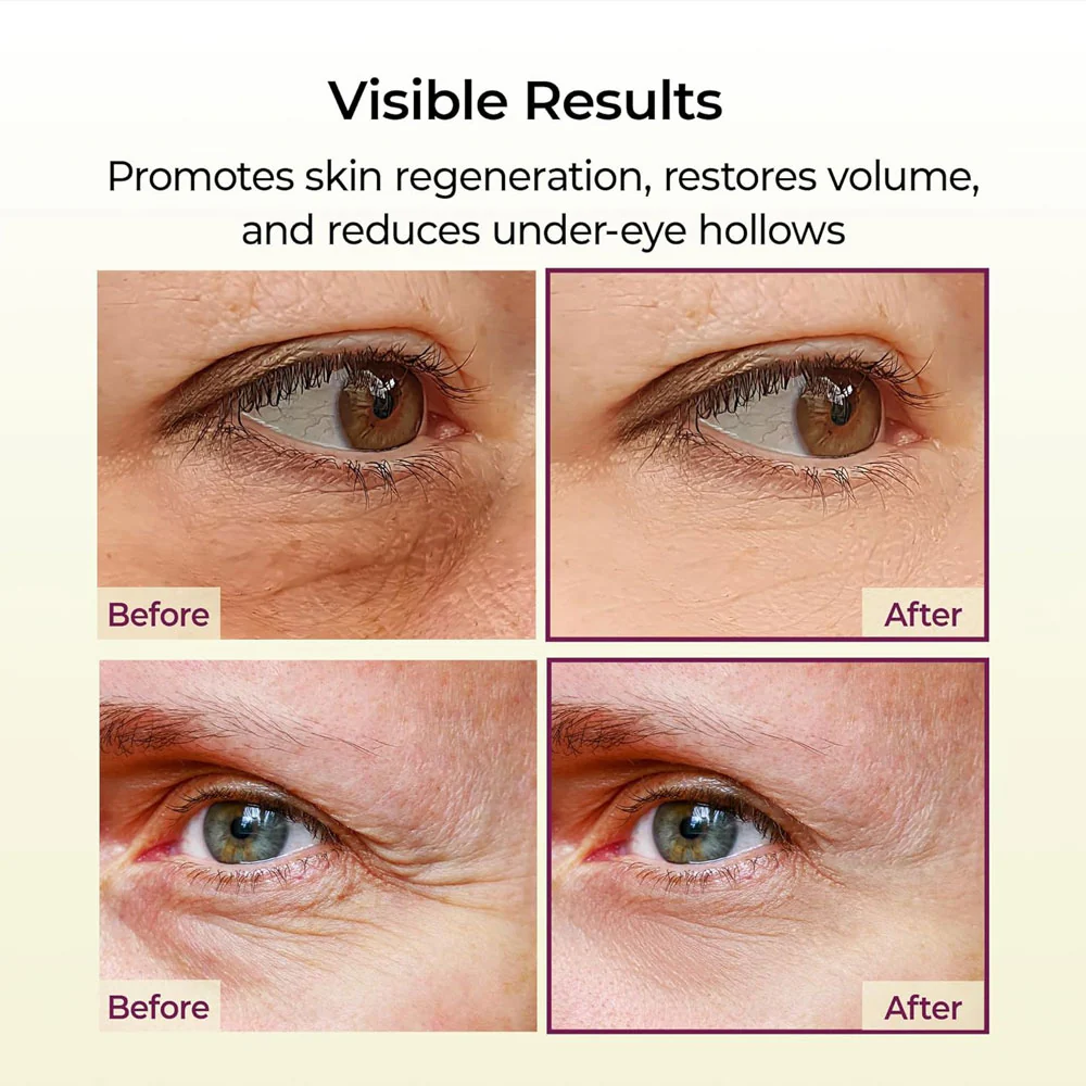 Dr.Melaxin Cemenrete Calcium Volume Multi Balm Dr.Melaxin