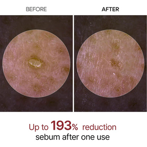 Dr.Melaxin Peel Shot Exfoliant Black Rice Ampoule Dr.Melaxin