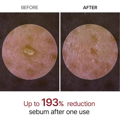 Dr.Melaxin Peel Shot Exfoliant Black Rice Ampoule