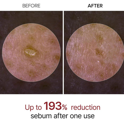 Dr.Melaxin Peel Shot Exfoliant White Rice Ampoule