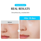 EQQUALBERRY Swimming Pool Ampoule
