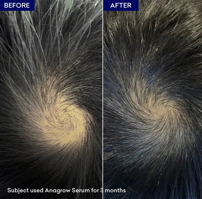 Jenpharm Anagrow Hair Growth Serum