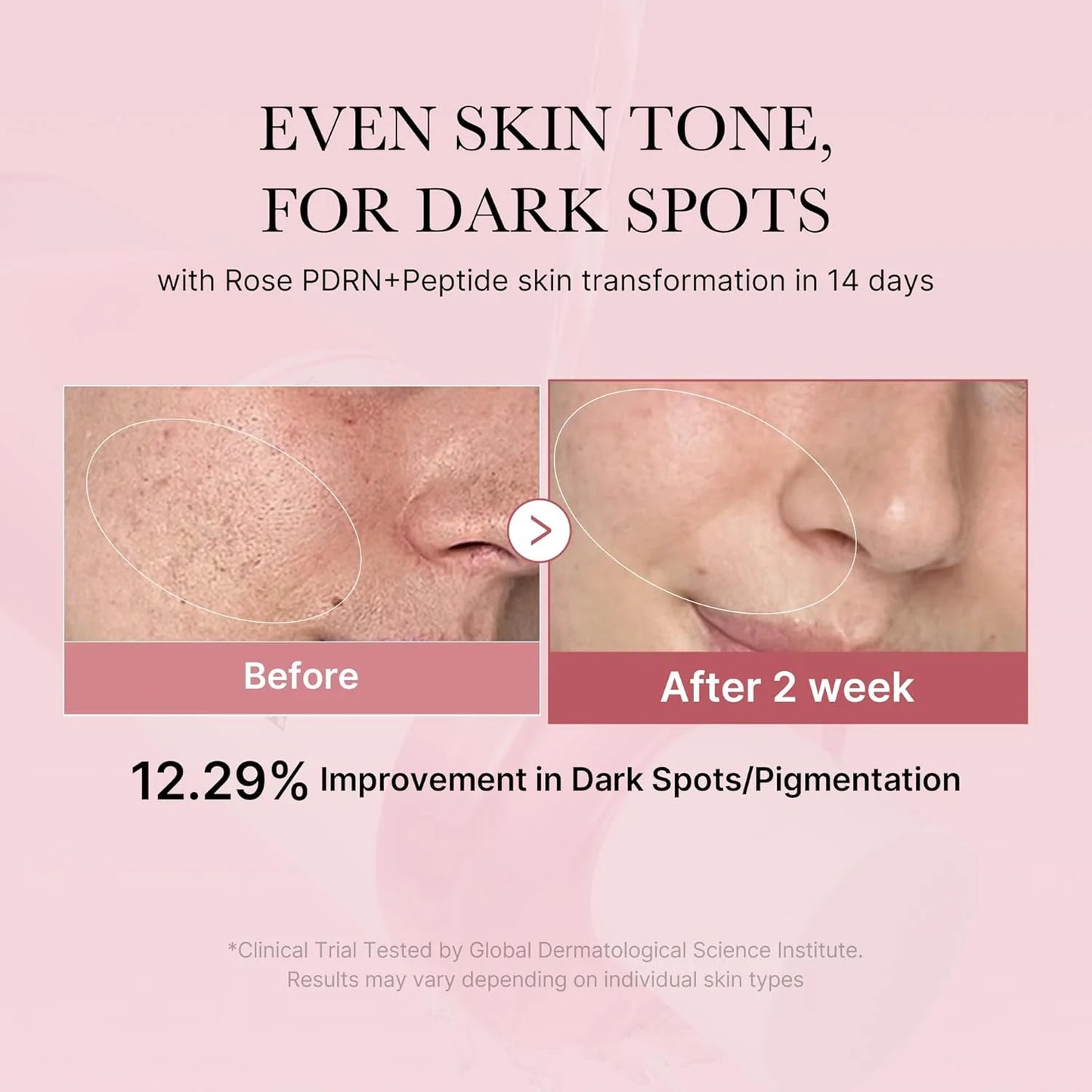 https://allurify.pk/products/medicube-pdrn-pink-cica-soothing-toner?variant=51734376251708