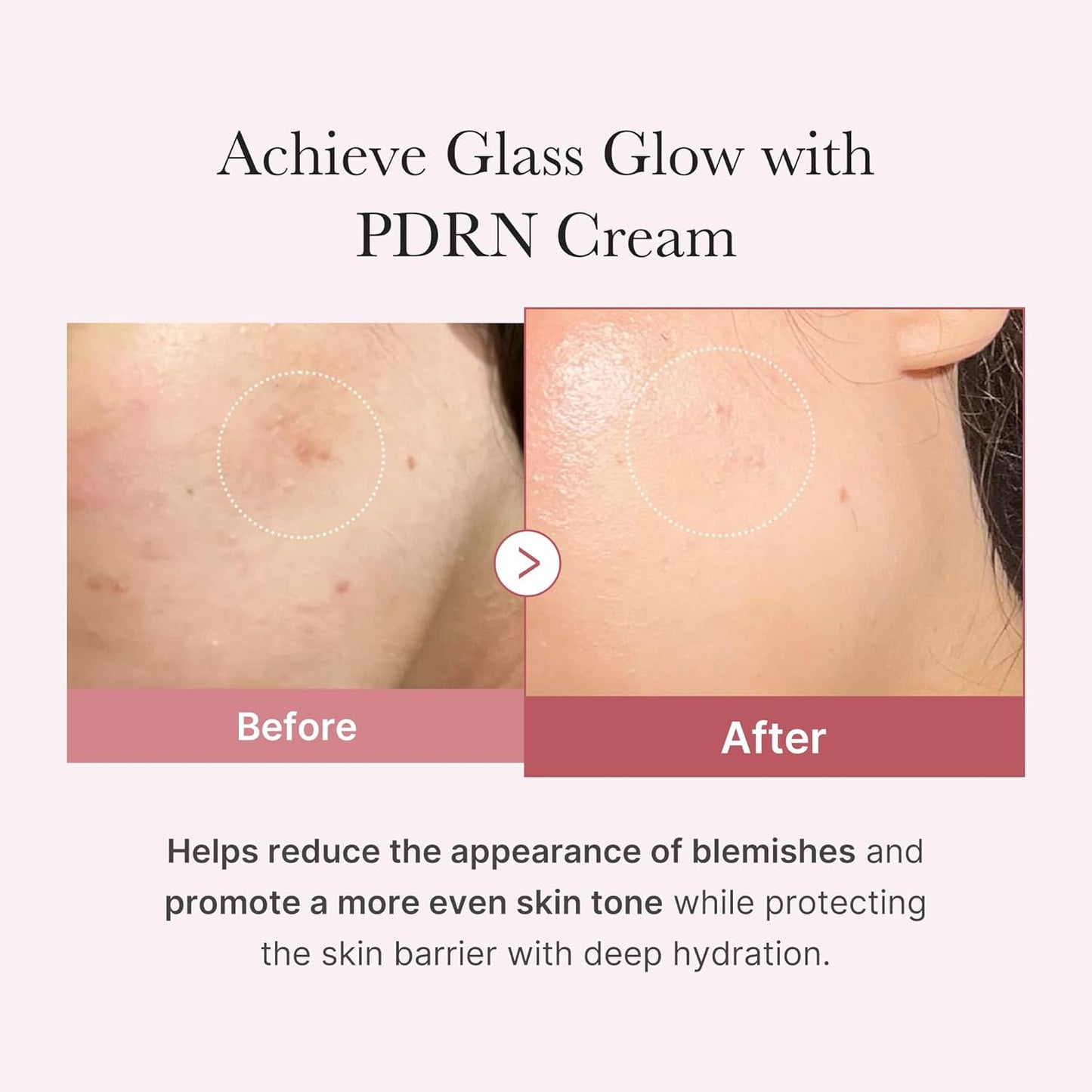 https://allurify.pk/products/medicube-pdrn-pink-hyaluronic-moisturizing-cream?variant=51734381232444