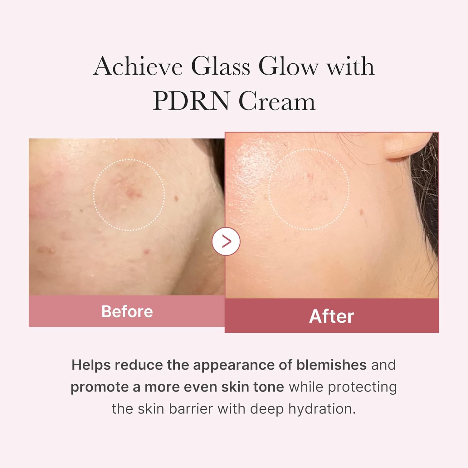 https://allurify.pk/products/medicube-pdrn-pink-hyaluronic-moisturizing-cream?variant=51734381232444