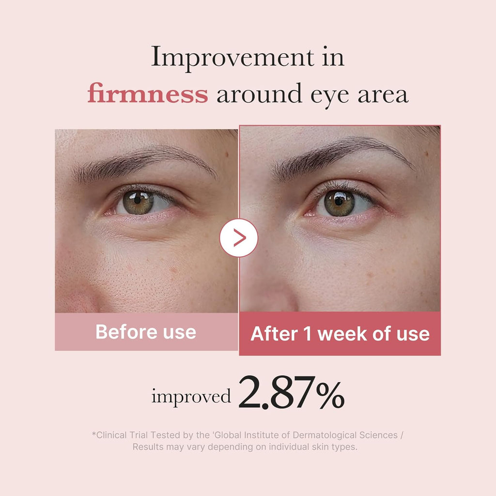 https://allurify.pk/products/medicube-pdrn-pink-peptide-eye-cream?variant=51735960420668