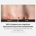 https://allurify.pk/products/medicube-zero-pore-toner-pads?utm_source=copyToPasteBoard&utm_medium=product-links&utm_content=web