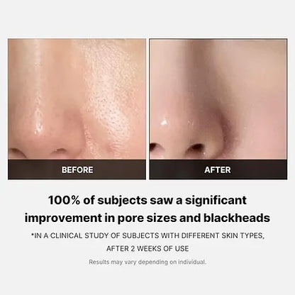 https://allurify.pk/products/medicube-zero-pore-toner-pads?utm_source=copyToPasteBoard&utm_medium=product-links&utm_content=web