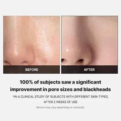 https://allurify.pk/products/medicube-zero-pore-toner-pads?utm_source=copyToPasteBoard&utm_medium=product-links&utm_content=web