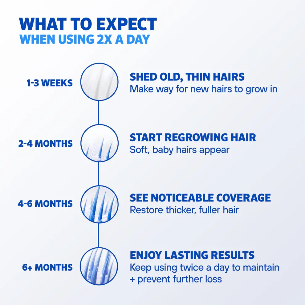 Rogaine Foam Men's Hair Regrowth Treatment 60g (3-Months Supply)