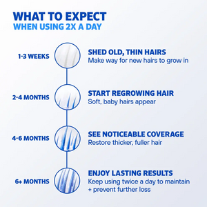 Rogaine Foam Men's Hair Regrowth Treatment 60g (3-Months Supply) Rogaine