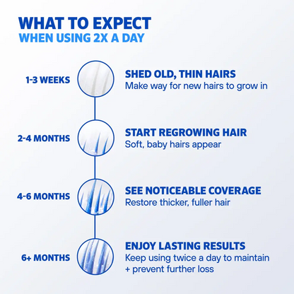 Rogaine Foam Men's Hair Regrowth Treatment 60g (3-Months Supply)