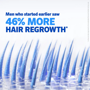 Rogaine Foam Men's Hair Regrowth Treatment 60g (3-Months Supply) Rogaine