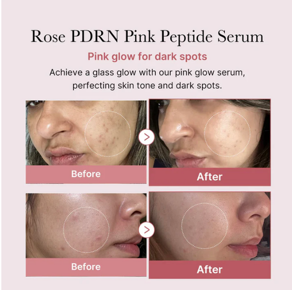https://allurify.pk/products/medicube-pdrn-pink-peptide-serum?variant=51170601468220