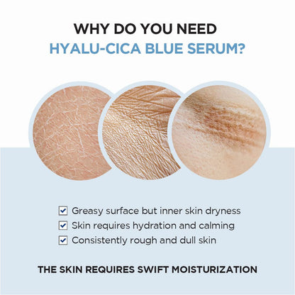https://allurify.pk/products/skin1004-hyalu-cica-blue-serum-multi-care-solutions?_pos=1&_psq=hyalu+cica+blue+serum&_ss=e&_v=1.0