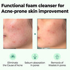 https://allurify.pk/products/some-by-mi-aha-bha-pha-30-days-miracle-acne-clear-foam?_pos=1&_psq=acne+aha+bha&_ss=e&_v=1.0