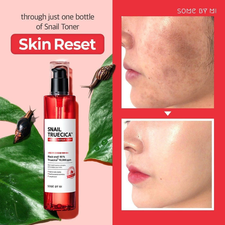 https://allurify.pk/products/some-by-mi-trucica-miracle-repair-toner?_pos=4&_sid=7d63b0bb0&_ss=r