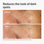 https://allurify.pk/products/the-ordinary-alpha-arbutin-2-ha-30ml?variant=51723054547260